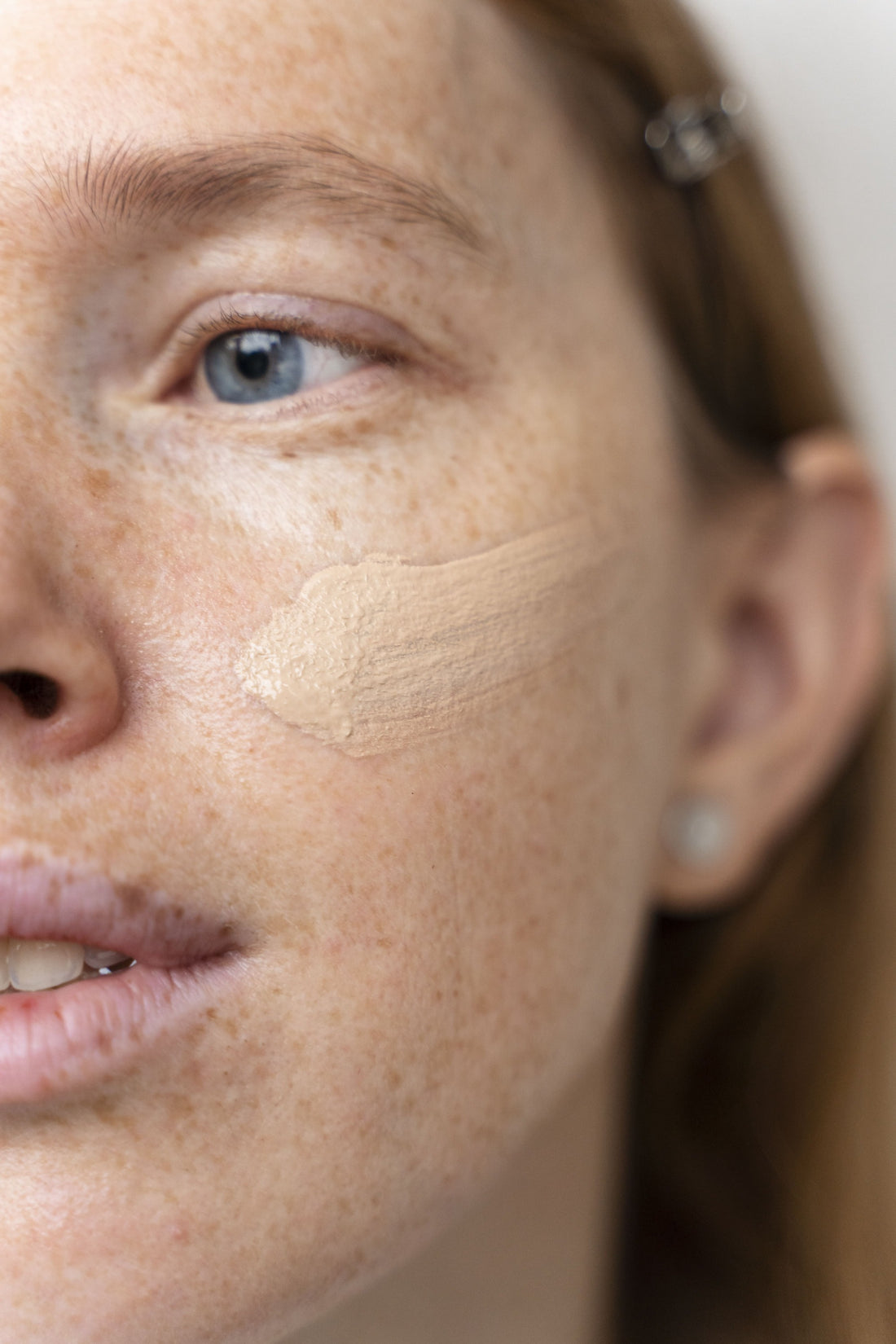 Como cuidar do melasma e evitar que ele piore?