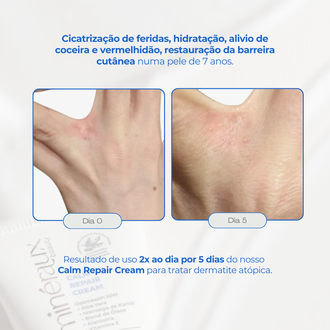 LANÇAMENTO | CALM REPAIR CREAM - 40ml