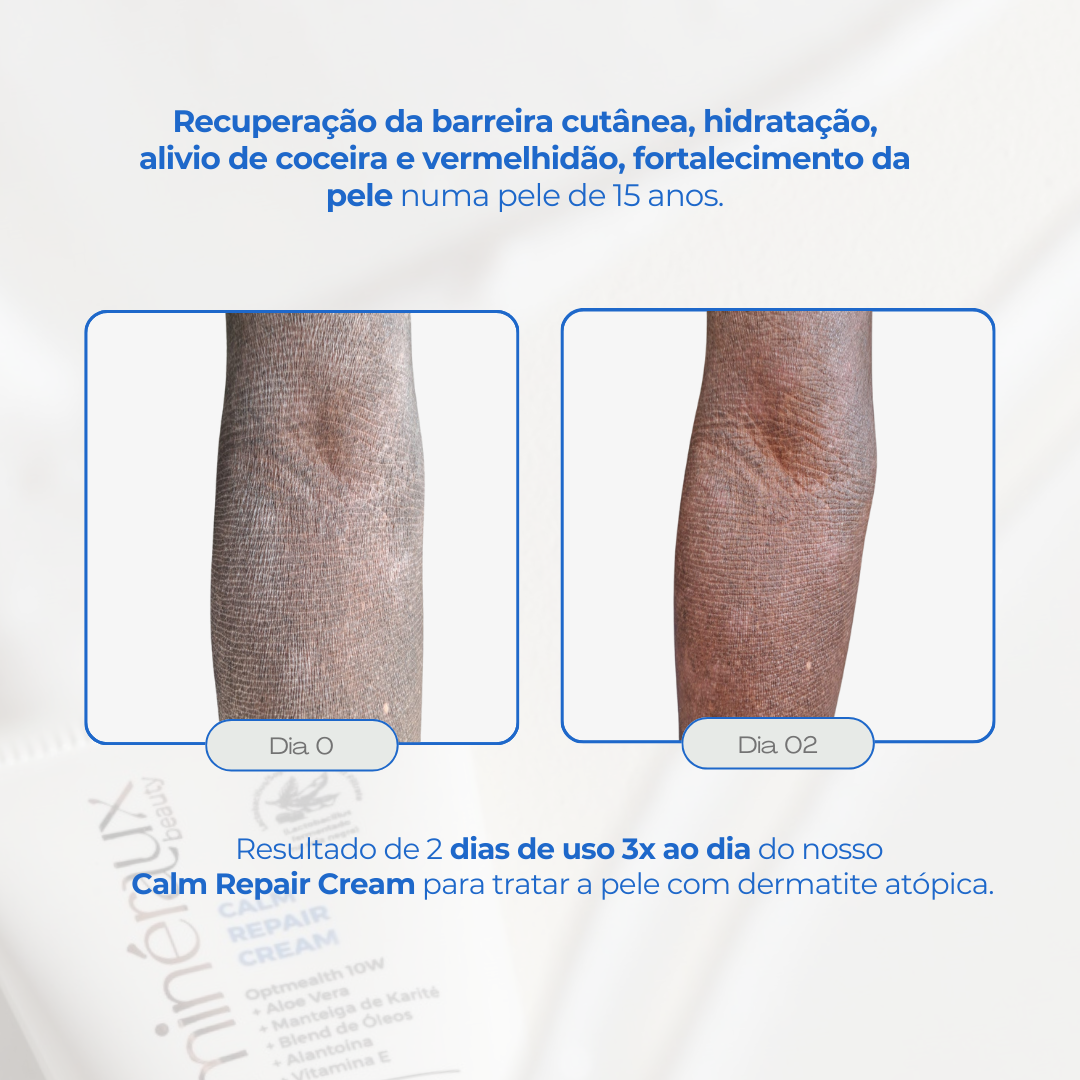 LANÇAMENTO | CALM REPAIR CREAM - 40ml