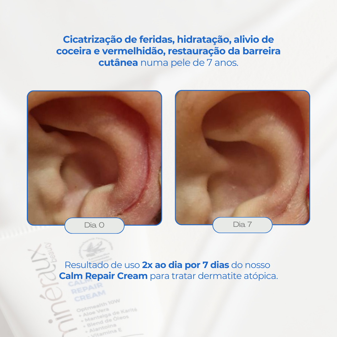 LANÇAMENTO | CALM REPAIR CREAM - 40ml