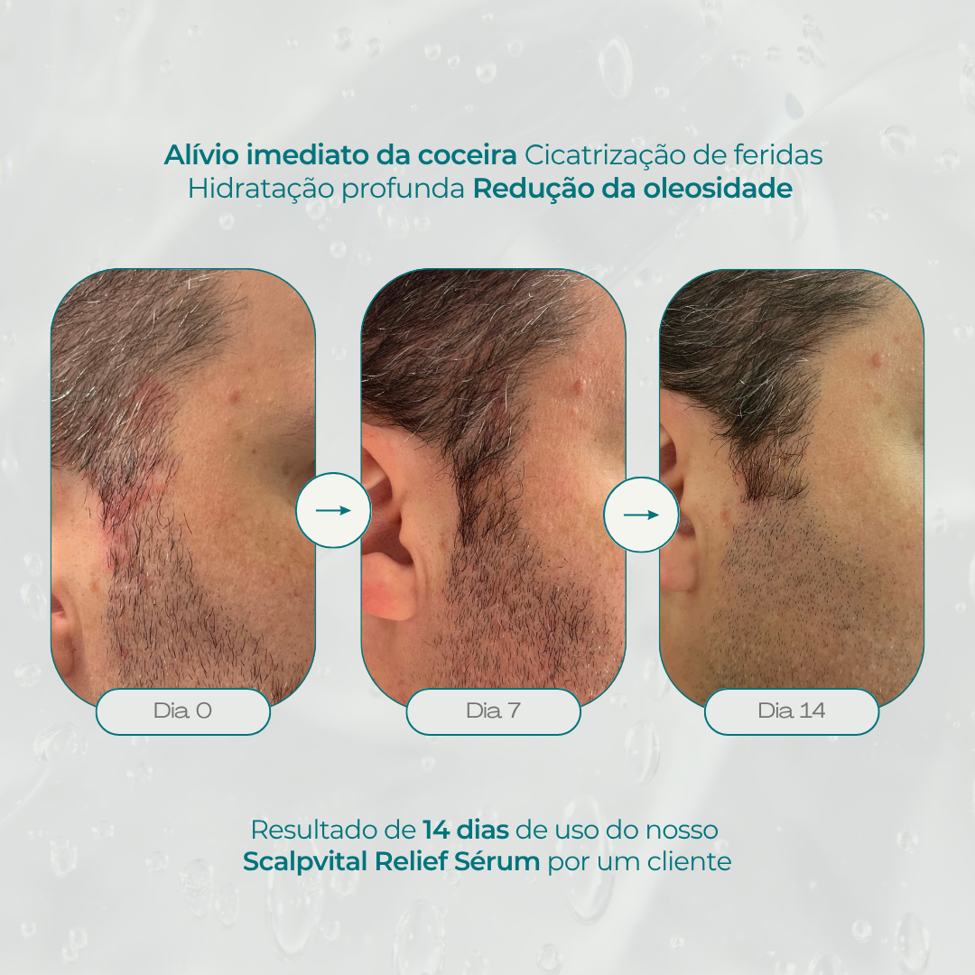 Scalpvital Relief Serum