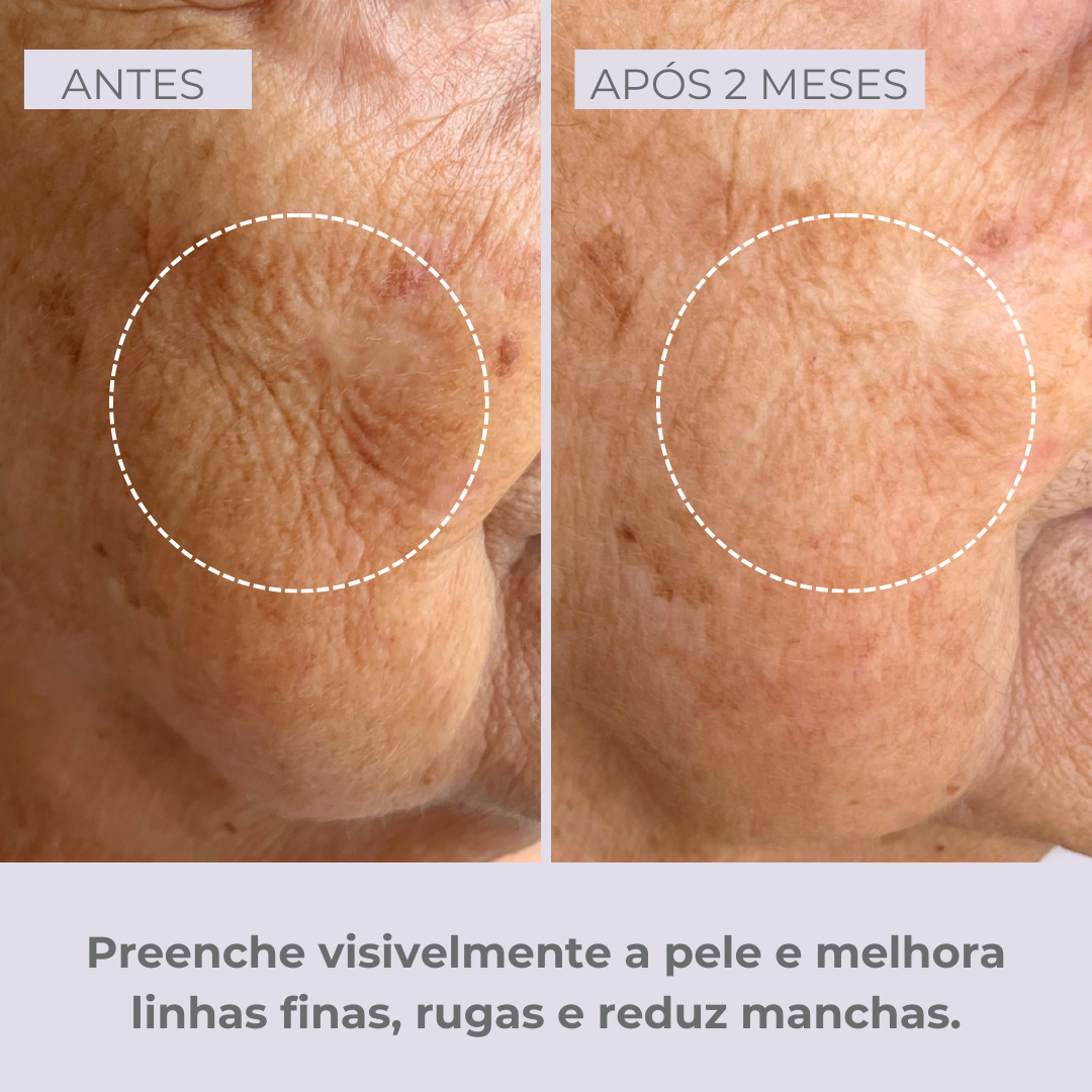 Retinol-like Bright Sérum +Niacinamide