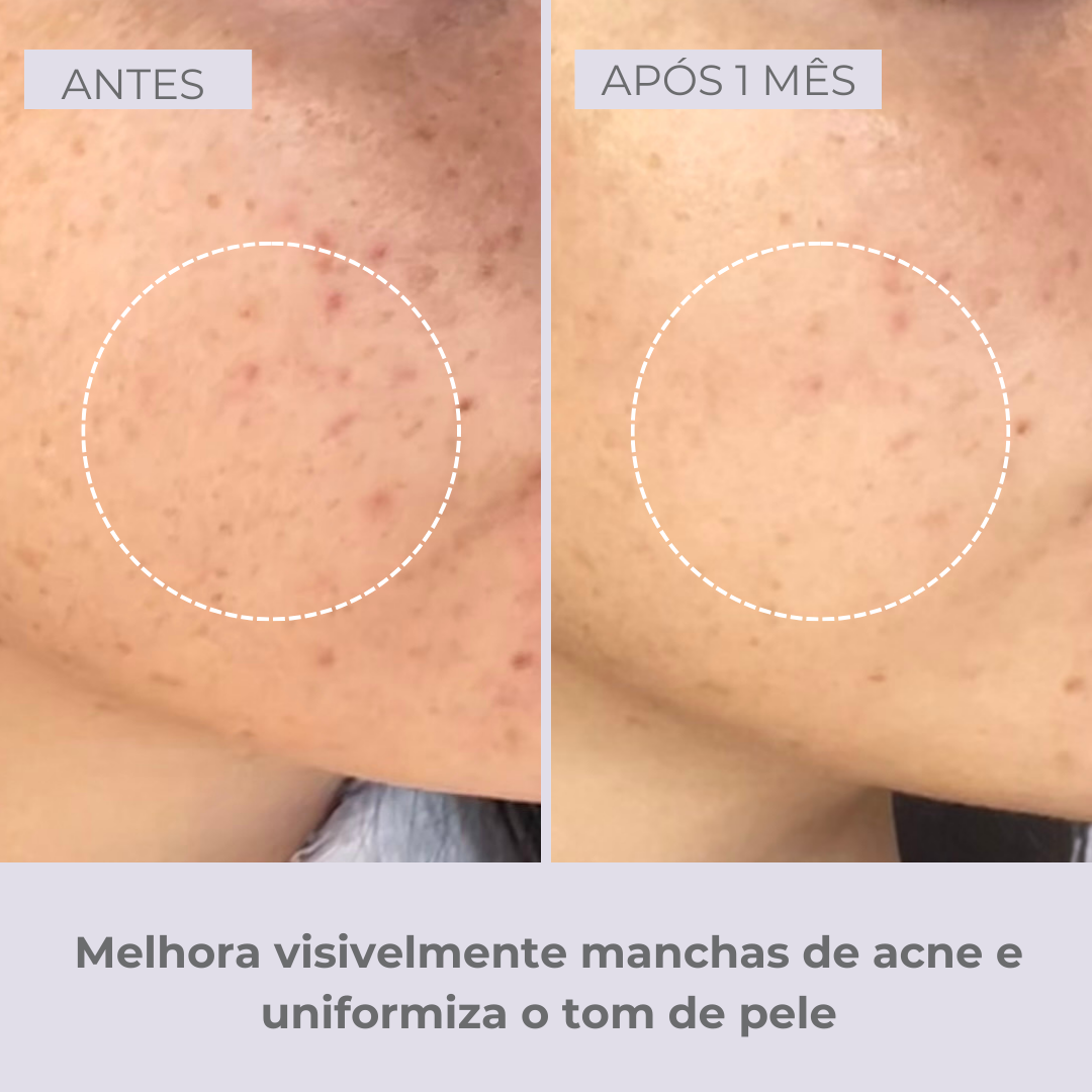 Retinol-like Bright Sérum +Niacinamide