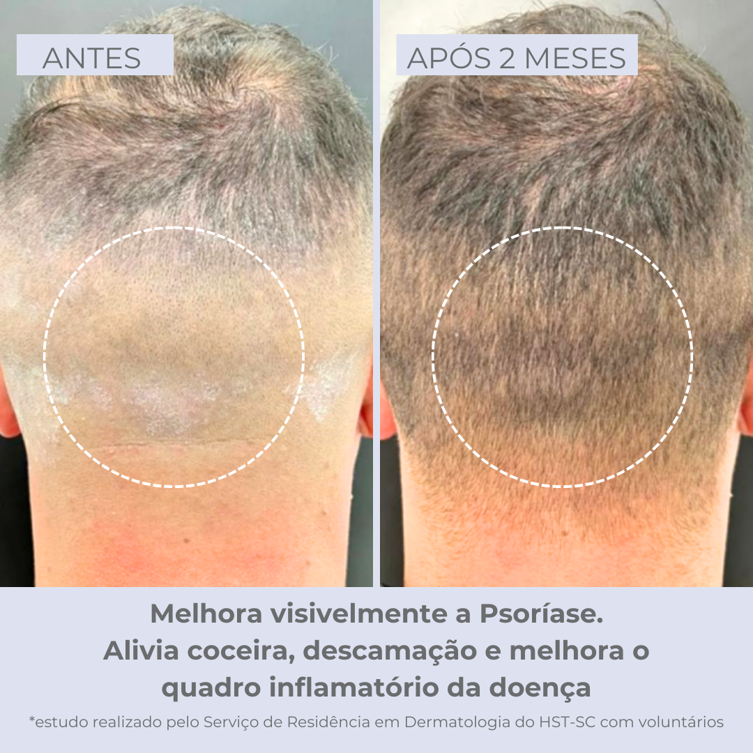 Scalpvital Relief Serum