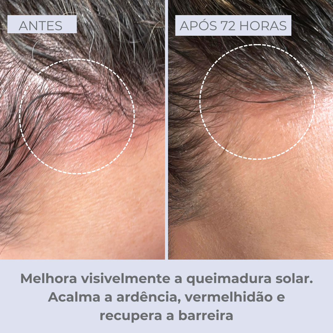 Scalpvital Relief Serum