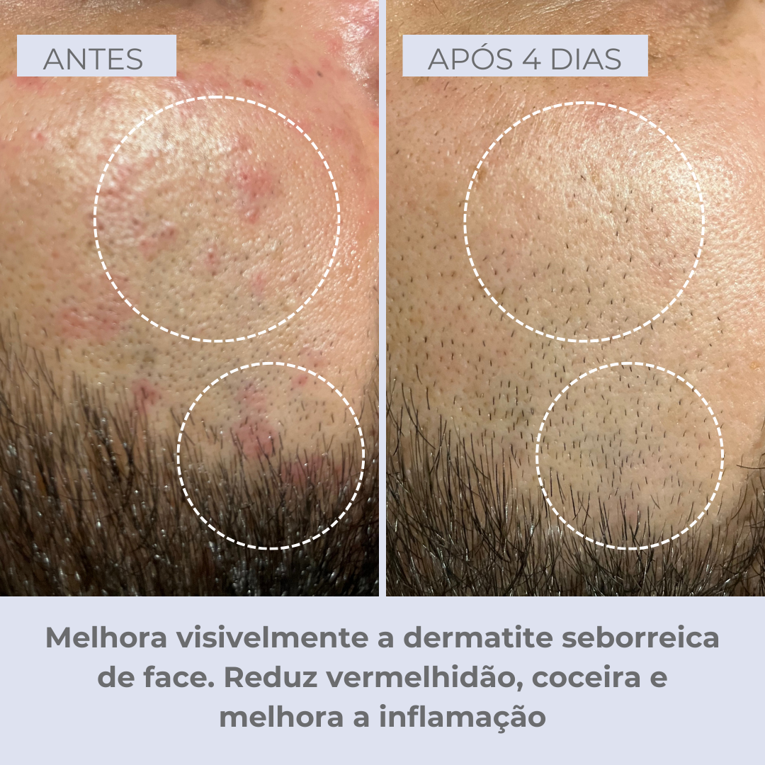 Scalpvital Relief Serum