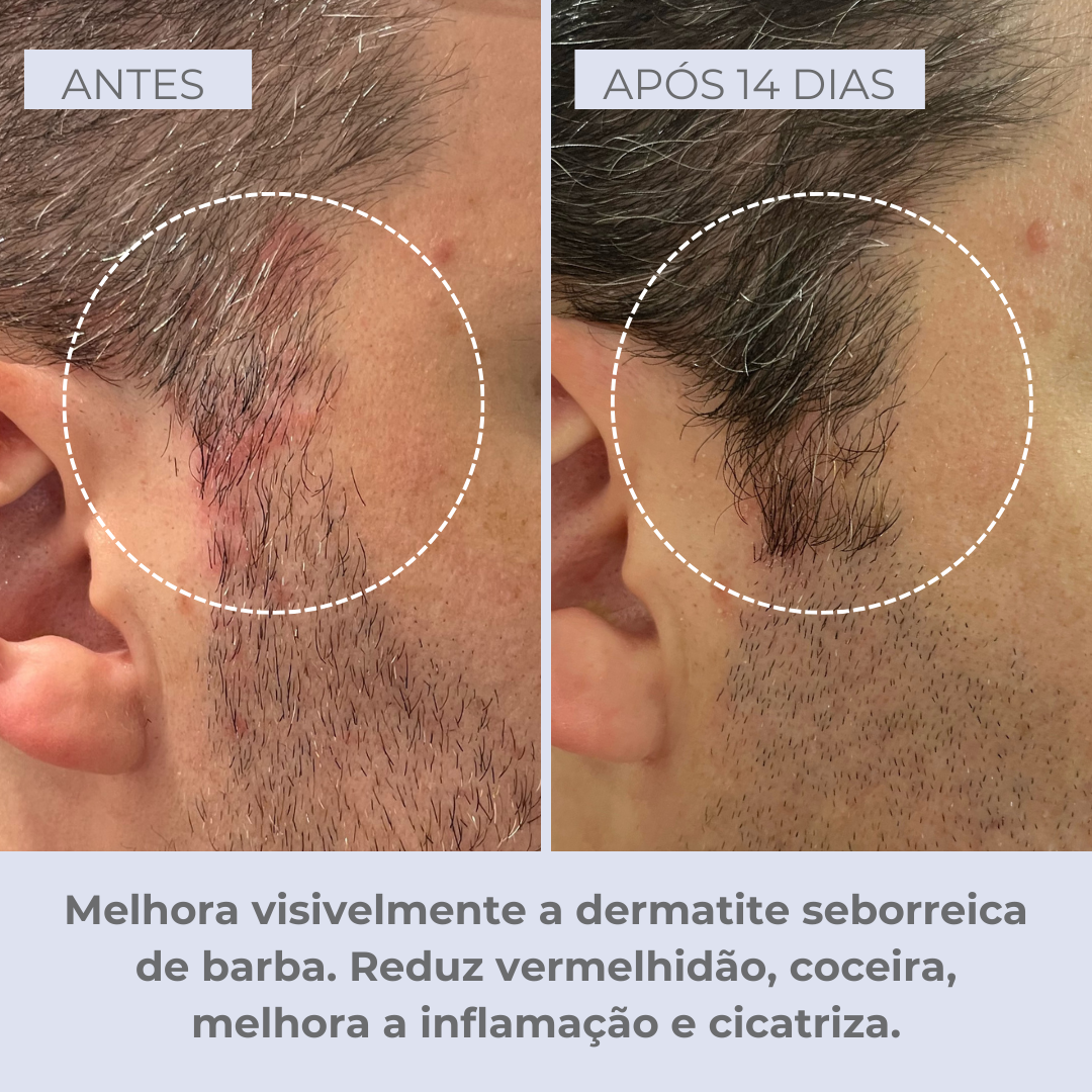 Scalpvital Relief Serum