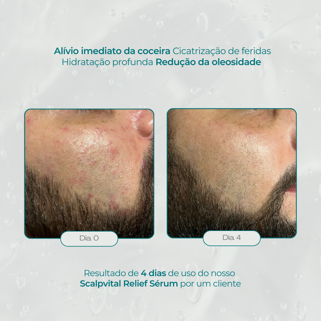 Scalpvital Relief Serum