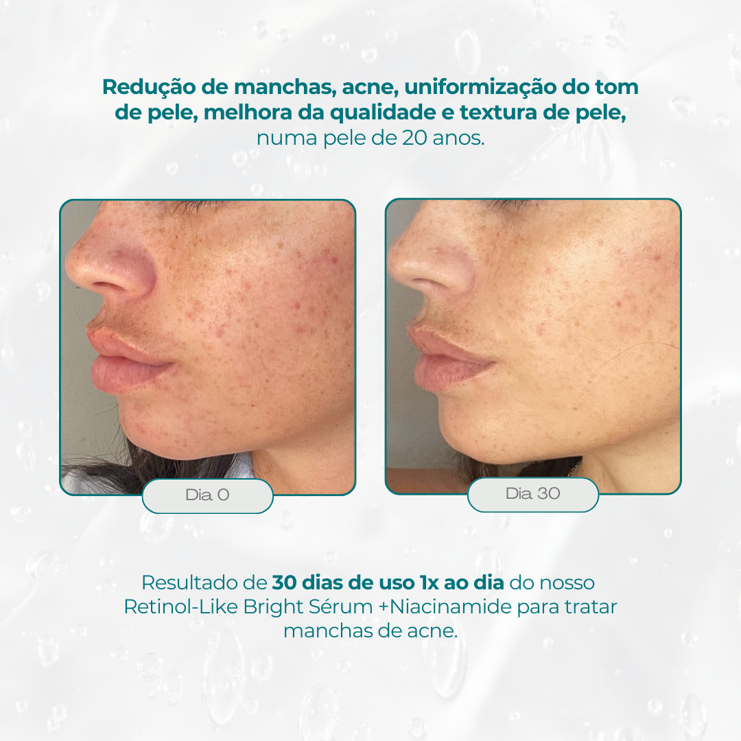 Retinol-like Bright Sérum +Niacinamide